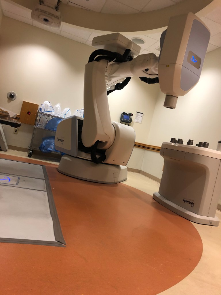 A CyberKnife stereotactic radiosurgery machine used to treat AVMs